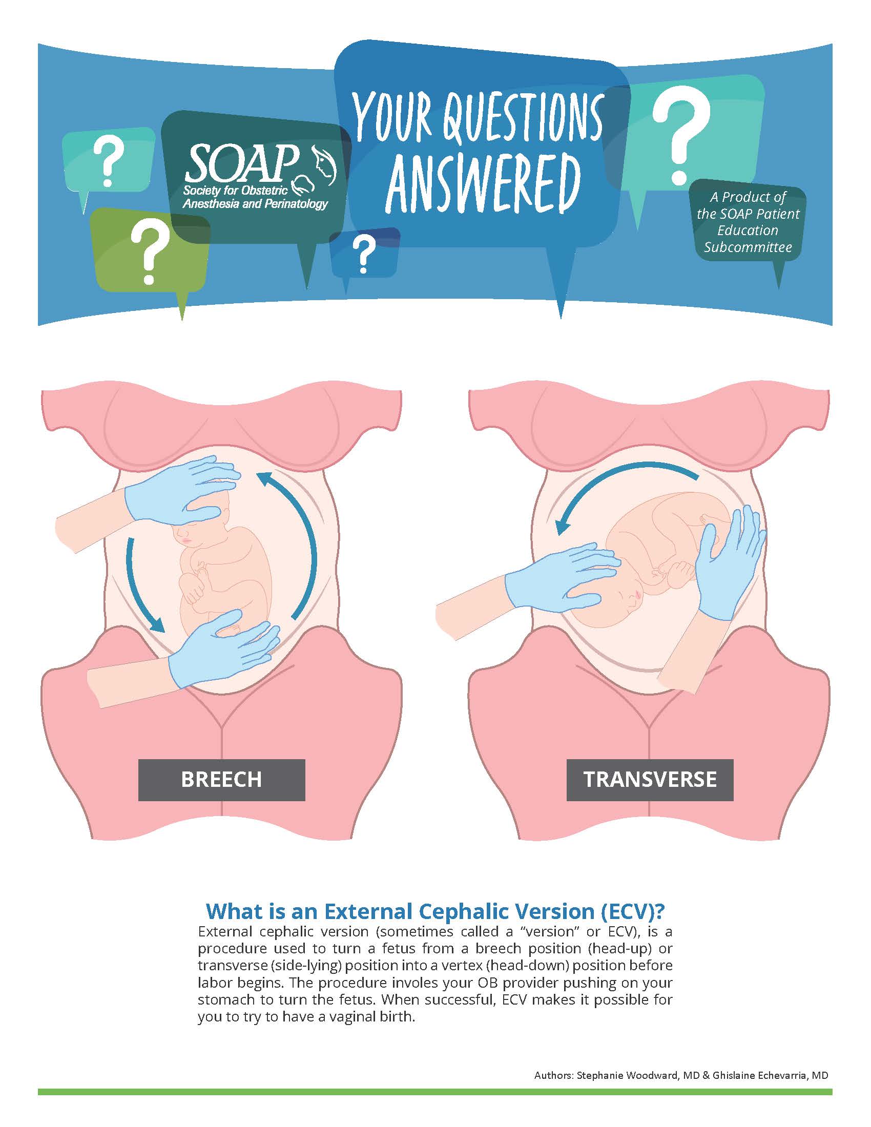 ECV Patient Education